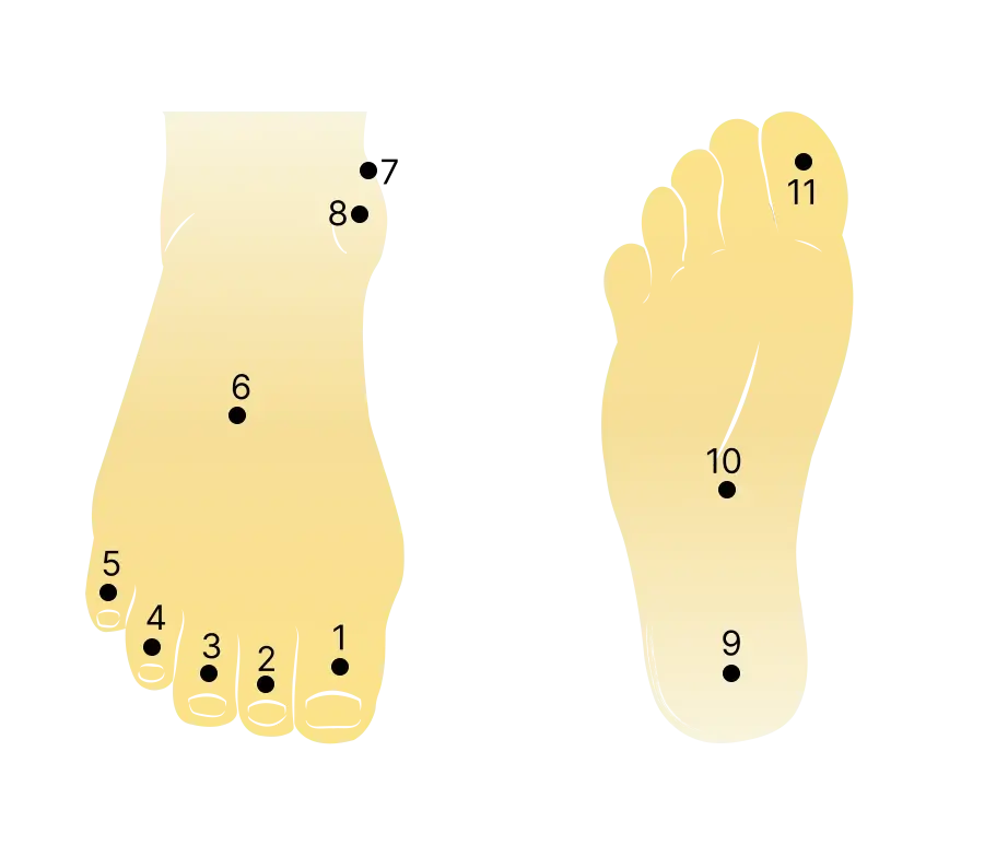 Nốt Ruồi Bàn Chân